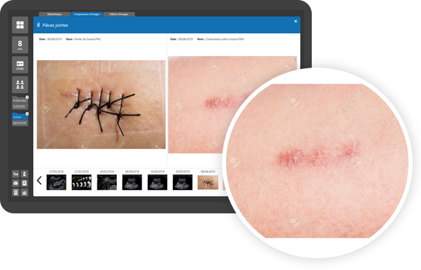 image-plaie image-plaie